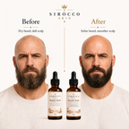 Bald-Headed Kings Duo – Beard Oil + Bald Head Oil Set