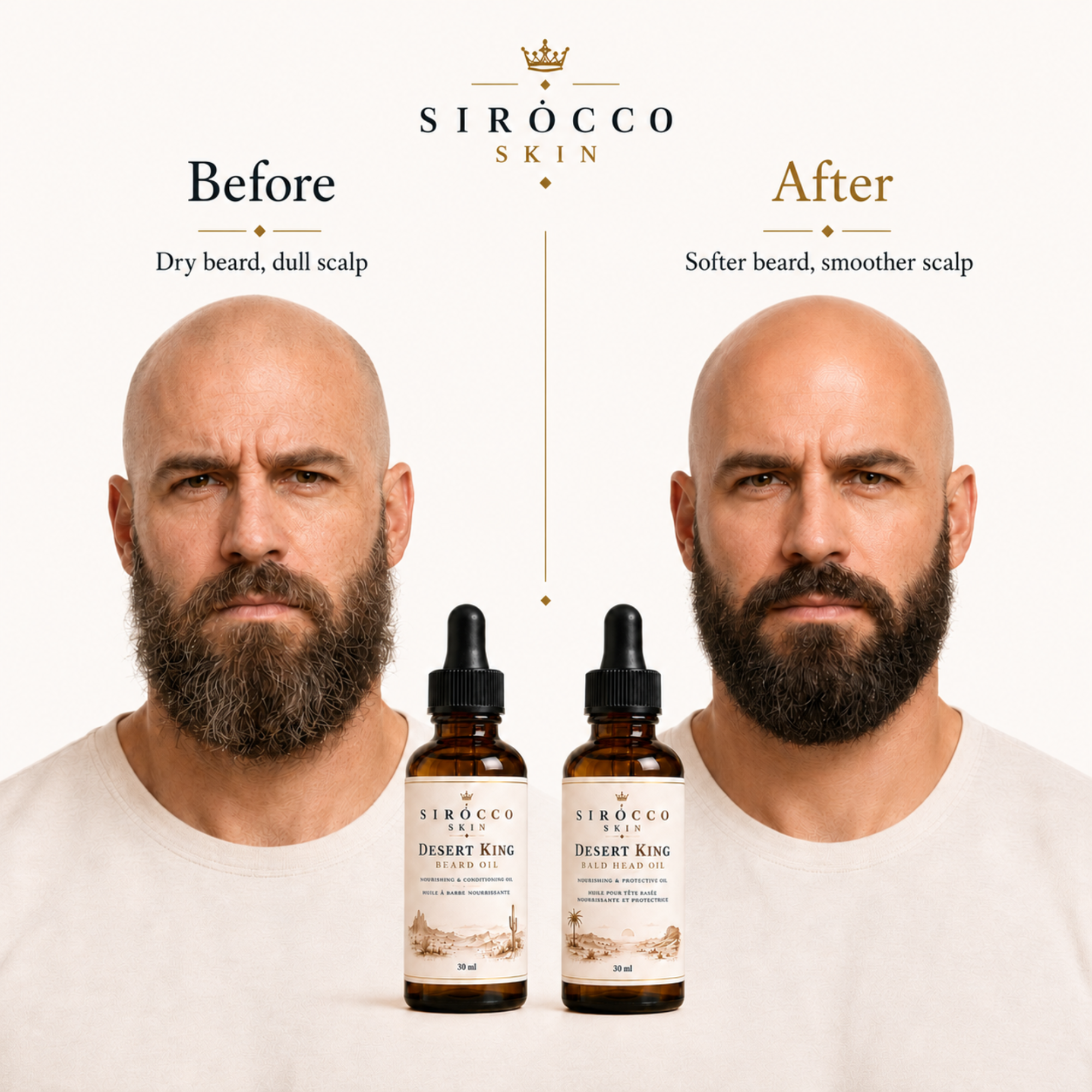 Bald-Headed Kings Duo – Beard Oil + Bald Head Oil Set